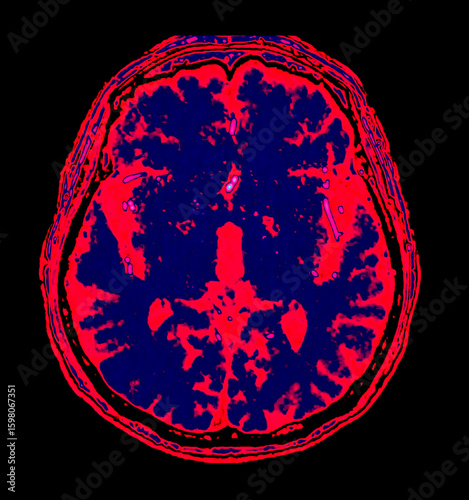 The color-enhanced MRI reveals the brain’s anatomy in striking hues. It showcases the complexity of thought, memory, and emotion. Science meets surreal beauty in the mind's inner world.