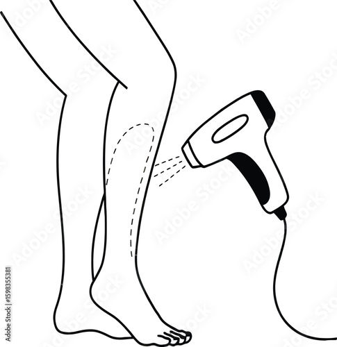 Illustration of a laser hair removal device being used on a person's leg in black and white style