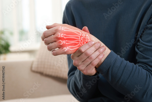 Foto Arthritis