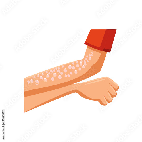 Skin rash on arm illustration showing symptoms of urticaria or allergies