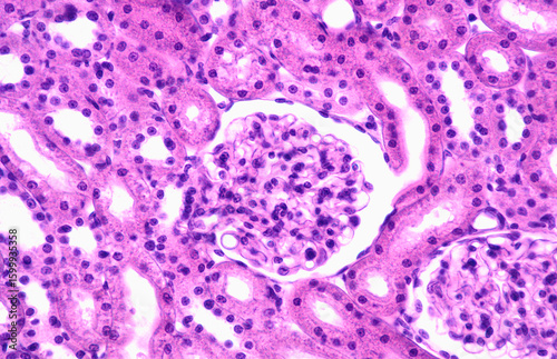 Renal corpuscle. Tubular and vascular poles
