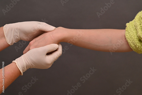 Fotografie Skin mark on wrist indicates surgical site of ganglion removal