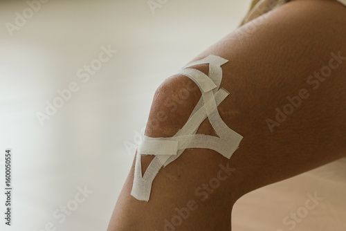 Close up of knee with medical tape and bandages, indicating recent injury or surgery, in clinical setting with soft lighting