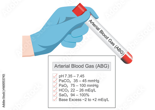 An Arterial Blood Gas (ABG) test is a crucial blood test.