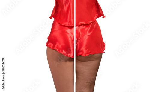 Woman's thighs and buttocks...