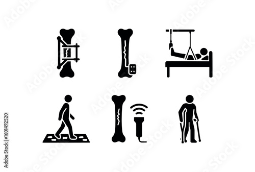solid icon isolated tibial fracture malunion correction osteotomy tibial fracture biomechanical load sensor tibial fracture skin traction kit tibial fracture gait analysis walkway tibial