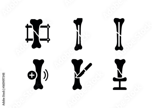 solid icon isolated tibial fracture eternal fiator frame tibial fracture intramedullary rod tibial fracture fibular stt graft tibial fracture bone stimulator tibial fracture compartment