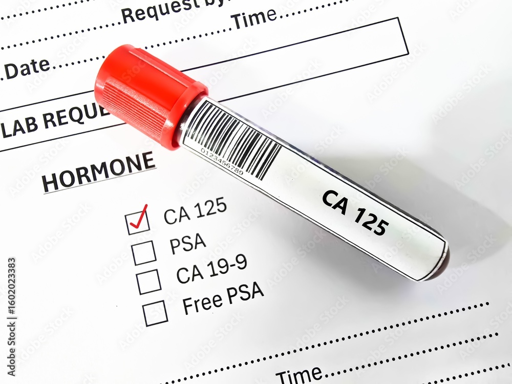 Obraz premium Blood sample tube and paper order request for CA 125 test analysis.