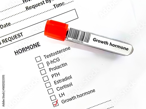 Blood sample tube and paper order request for growth hormone test analysis.
