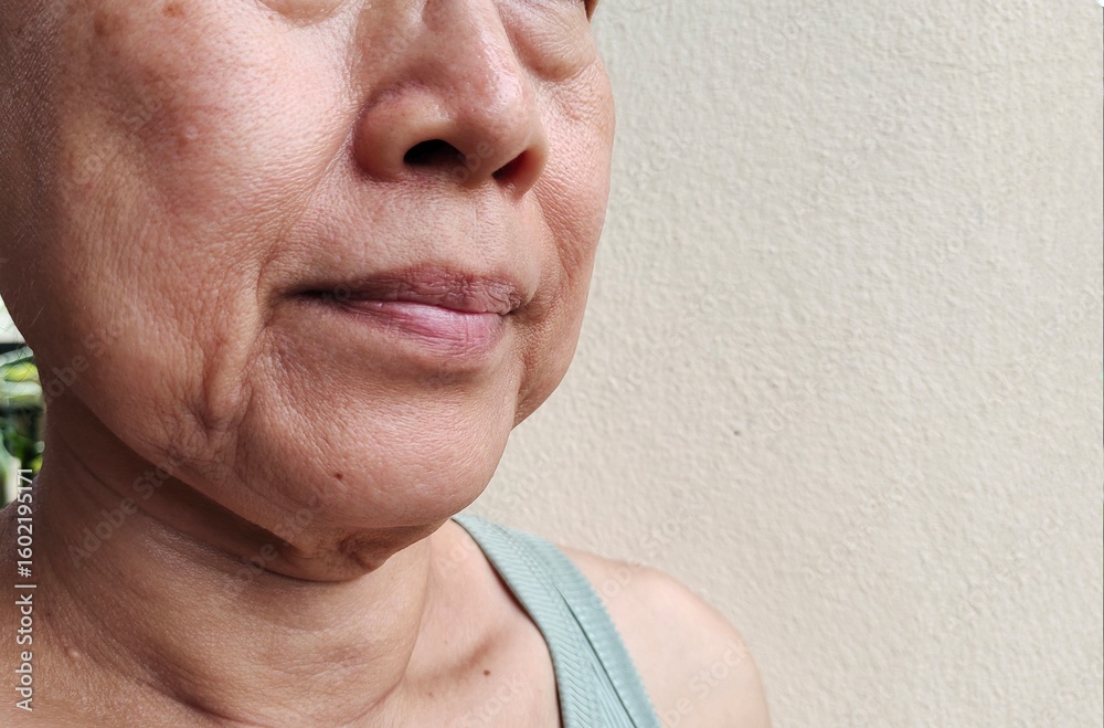 Obraz premium Portrait the Flabbiness and wrinkle beside the mouth, smile lines and scar, dark spots and blemish on the face, health care and beauty concept.