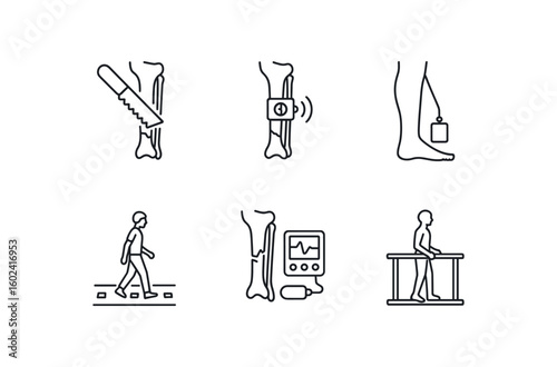 straight perfect stroke icon mono icons style isolated tibial fracture malunion correction osteotomy tibial fracture biomechanical load sensor tibial fracture skin traction kit tibial