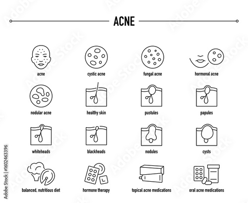 Acne symptoms, diagnostic and treatment vector icon set. Line editable medical icons