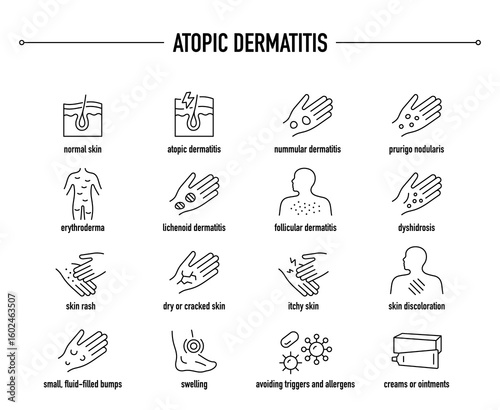 Atopic Dermatitis symptoms, diagnostic and treatment vector icon set. Line editable medical icons