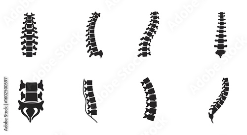 Eight different views of a human spine, displayed in black silhouette against a white background.
