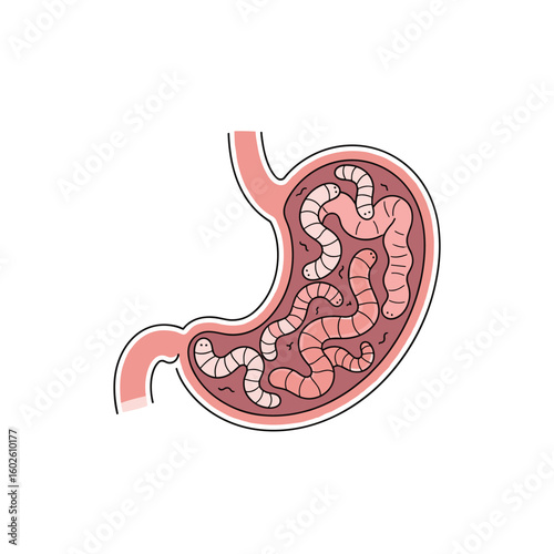 Digestive system internal view showing many worms inside the stomach and intestines