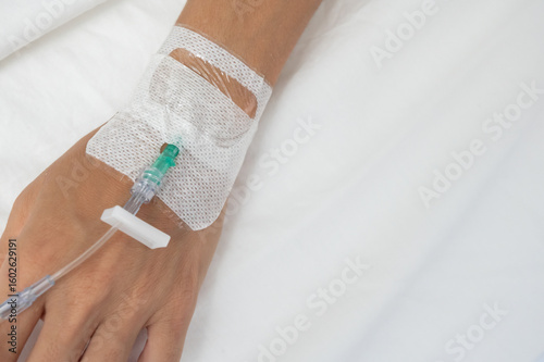 Photos Close-up of a cannula inserted into patient's hand for intravenous therapy