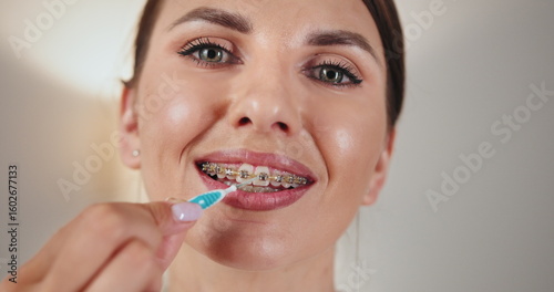Close-up of young Caucasian woman using dental irrigator to clean braces. Promotes oral hygiene and dental care. Showcases routine for maintaining healthy gums and teeth.