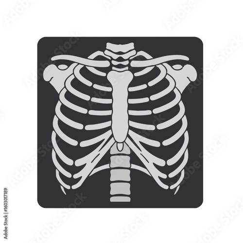 Vector illustration of x-ray with ribs flat style on white background, medical diagnostic