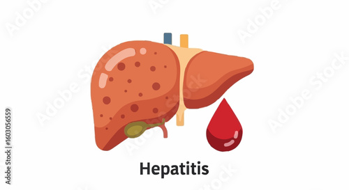 Hepatitis virus affecting liver with blood drop symbol