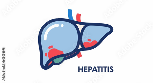 Understanding Hepatitis A virus infection symptoms and treatment options