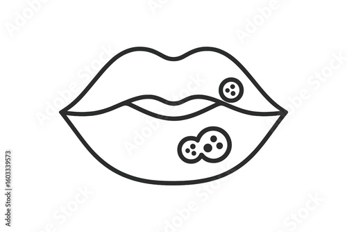 Herpes lips icon. Cold sore on mouth, symbol of viral infection. Medical vector illustration for dermatology, medicine packaging. Health problem, disease symptom outline logo.