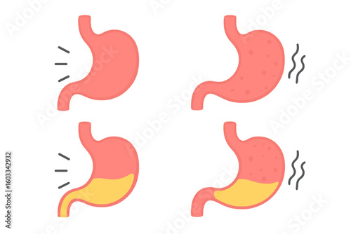 Human stomach anatomy set. Healthy and unhealthy, empty and full stomach vector illustration. Internal organ for digestive system care, nutrition, gastric acid, pain concepts.