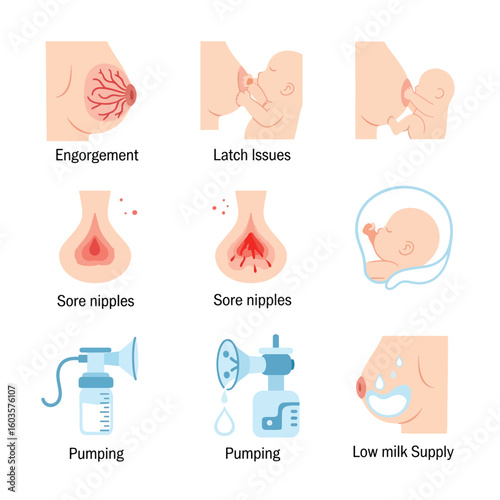 Illustrations depicting various breastfeeding challenges and solutions, showing related issues.