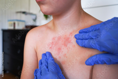 The doctor is assessing the boy's skin for signs of infectious diseases.