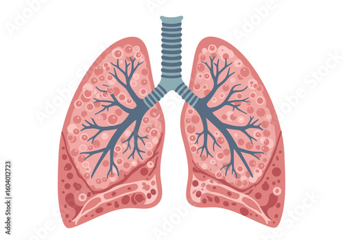 An illustration of lungs with bronchioles alveoli and trachea