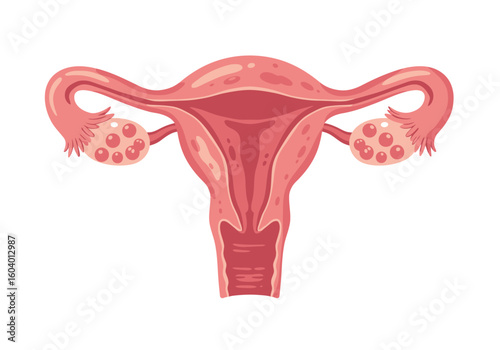 Anatomical illustration of a uterus fallopian tubes and ovaries in a pink and red hue