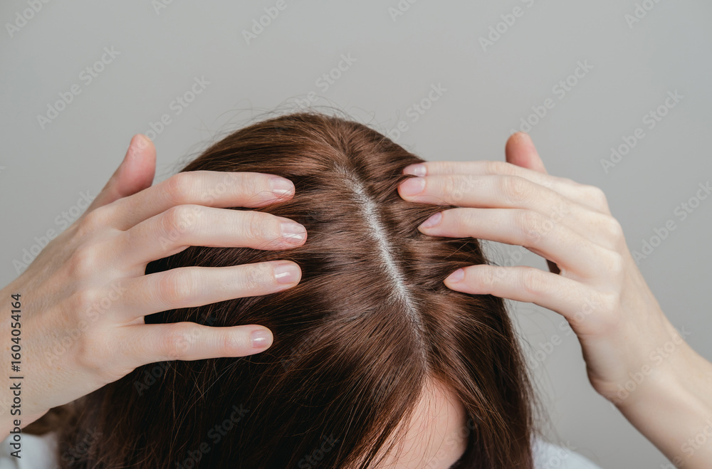 Fototapeta premium Woman is worried about hair loss problem. Health care, beauty treatment, hair loss problem.Treatment for hair loss due to stress and depression