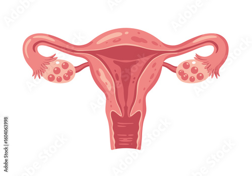Anatomical illustration of a uterus fallopian tubes and ovaries in a pink and red hue