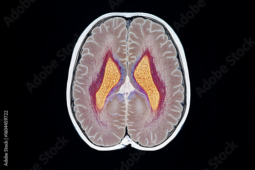 Axial Brain Scan: Visualization of a human brain, showcasing structures and indicating potential medical applications and neurological research.