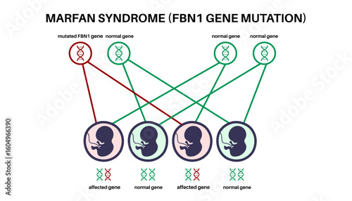 Marfan syndrome poster