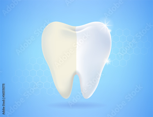 Half dirty yellow and whitening clean tooth isolated on bright blue background. Concept of healthy tooth, dental health, dentistry, hygiene toothbrush and toothpaste. Vector illustration.