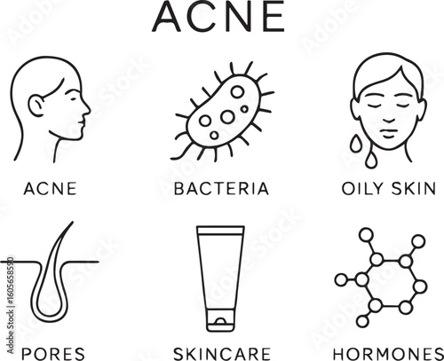 Illustration of acne causes and treatments, highlighting bacteria, hormones, pores, and skincare solutions with a focus on oily skin and topical treatment for clear skin acne skin problem icon
