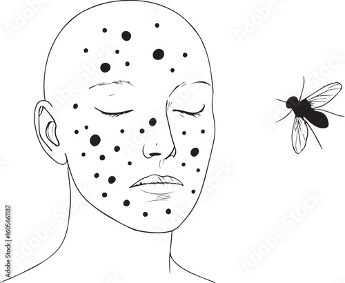 Minimalist line art of a face with acne spots and a fly hovering, showcasing skin imperfections, acne skin problem icon