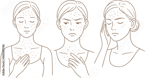 Line art series of a woman with acne on the chest and face, showing emotions like discomfort and concern, representing acne and allergy symptoms, acne skin problem icon