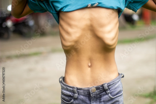 A small boy shows his chest, navel and the background is blurred