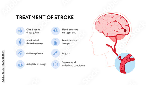 Brain neural disease for healthcare infographic. Vector flat illustration. Treatment of stroke poster and icon set. Design for health care