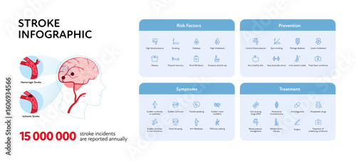 Brain neural disease for healthcare infographic. Vector flat illustration. Icon set set for risk factors, prevention, symptoms and treatment of stroke. Head and brain side view. Design for health care