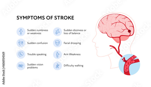 Brain neural disease for healthcare infographic. Vector flat illustration. Symptoms of stroke poster and icon set. Design for health care