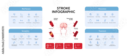 Brain neural disease for healthcare infographic. Vector flat illustration. Icon set set for risk factors, prevention, symptoms and treatment of stroke and statistics. Design for health care