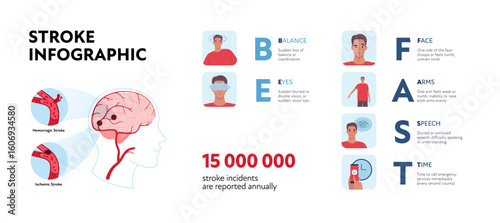 Brain neural disease for healthcare infographic. Vector flat illustration. Be fast stroke diagnostics with symptoms poster. Design for health care