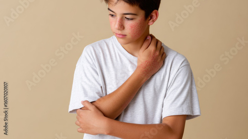 Teenage boy with red patches on face and arms, scratching skin affected by eczema or dermatitis 