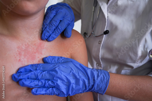 The boy's skin condition suggests an allergic reaction.