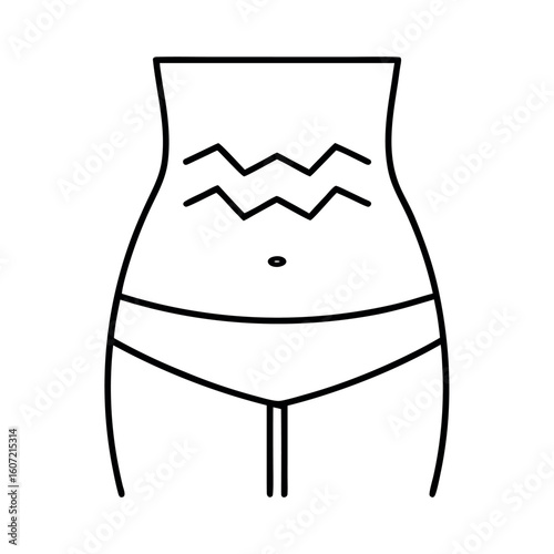 Braxton Hicks Illustration Zigzag Lines on Belly Shape Representing Contractions in Pregnancy
