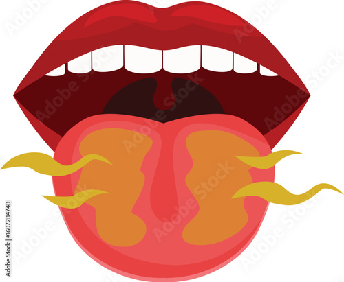 Open mouth showing burning tongue representing spicy food or burning mouth syndrome