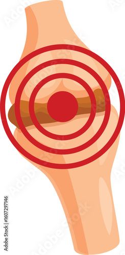 Red target symbol indicating inflammation and pain in a knee joint, emphasizing orthopedic health problems