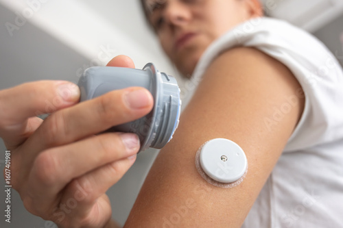 Foto Patient inserting continuous glucose monitoring sensor on arm for diabetes contr